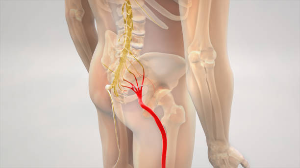 Hernia discal y la ciática: ¿cómo se pueden tratar?