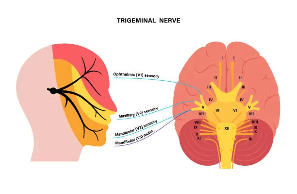 ¿Por qué el especialista en neuralgia del trigémino es clave en su diagnóstico?
