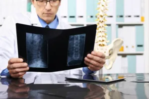 Un plan personalizado hace la diferencia en el tratamiento para hernia de disco