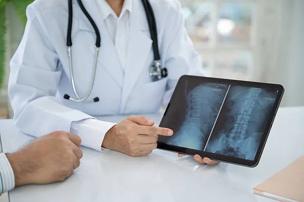 ¿Cuándo es estrictamente necesaria una operación de hernia discal_ 2 médico mostrando pantalla